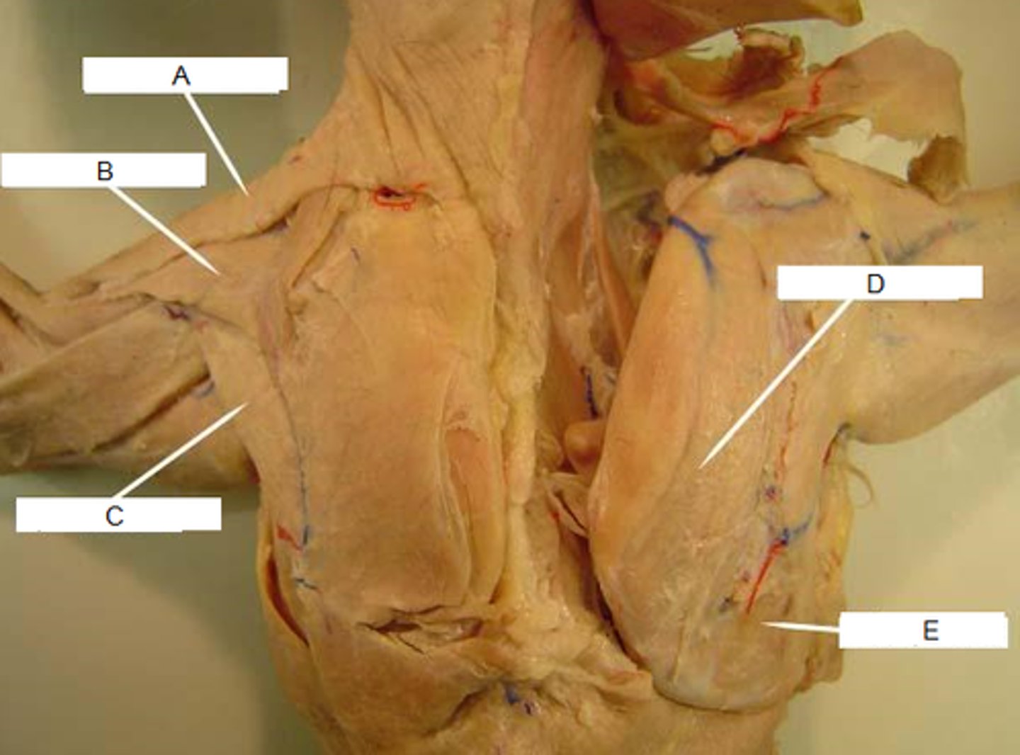 <p>What muscle is indicated by letter D? What is an attachment point and function?</p>