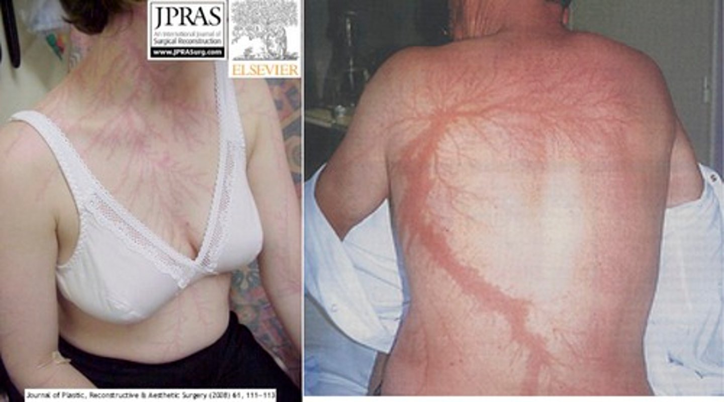 <p>-be sure no lice electricity<br>-cover entry and exit wounds<br>-monitor ABCs</p>