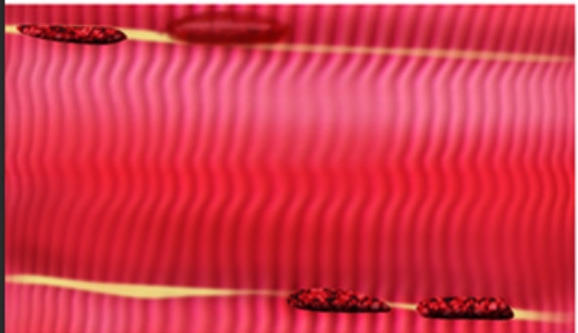<p>Elongated cells, forming contractions and movements</p>