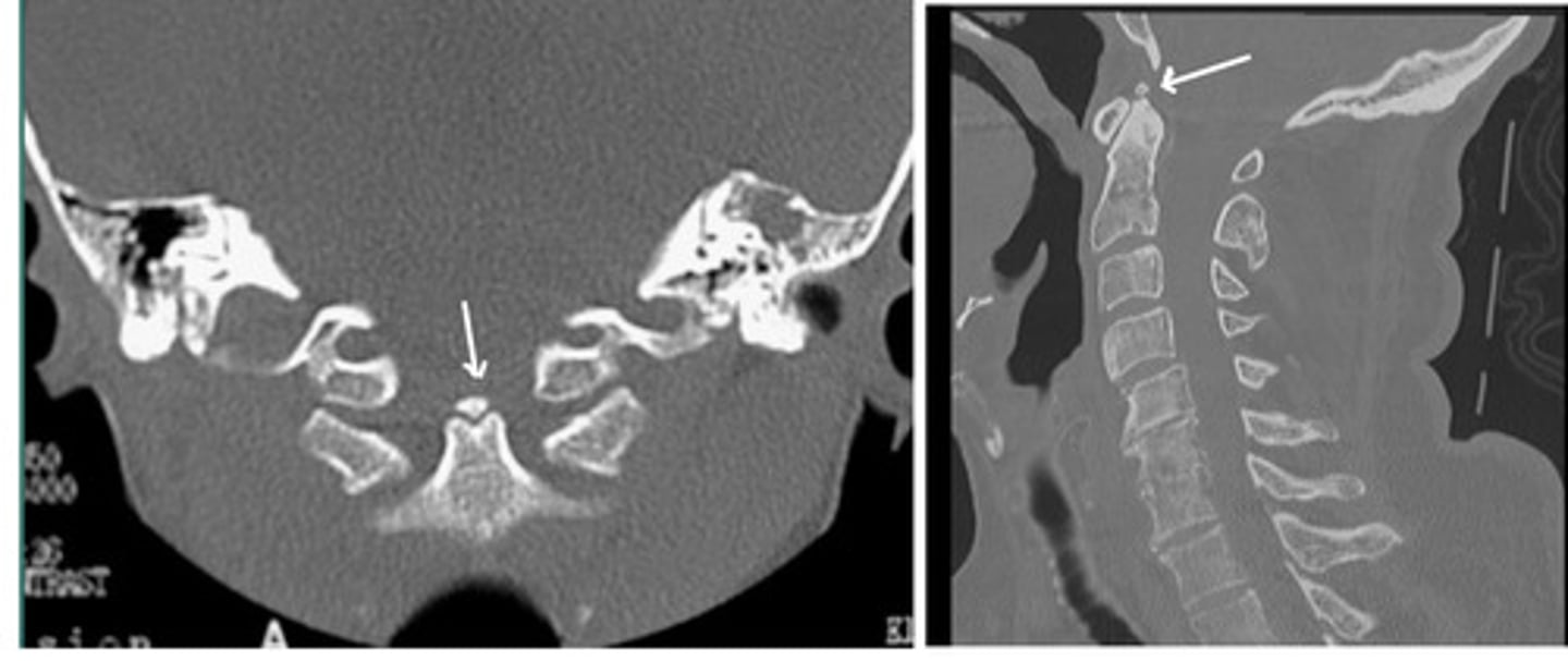 <p>What anomaly is this?</p>
