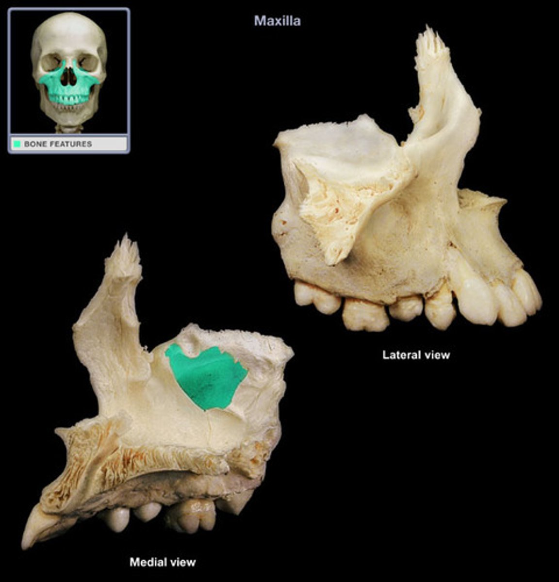 <p>Forms the anterior two thirds of floor of the nasal cavities.</p>
