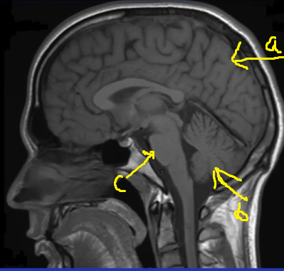 <p>Identify the position of the brain structure. [3 mark]</p>