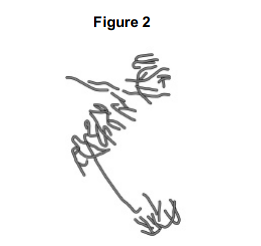 <p>A scientist treated growing tips of onion roots with a chemical that stops roots growing. After 24 hours, he prepared a stained squash of these root tips. </p><p>Figure 2 is a drawing showing the chromosomes in a single cell observed in the squash of one of these root tips in anaphase. This cell was typical of other cells in anaphase in these root tips. </p><p>Use all of this information to suggest how the chemical stops the growth of roots.</p>