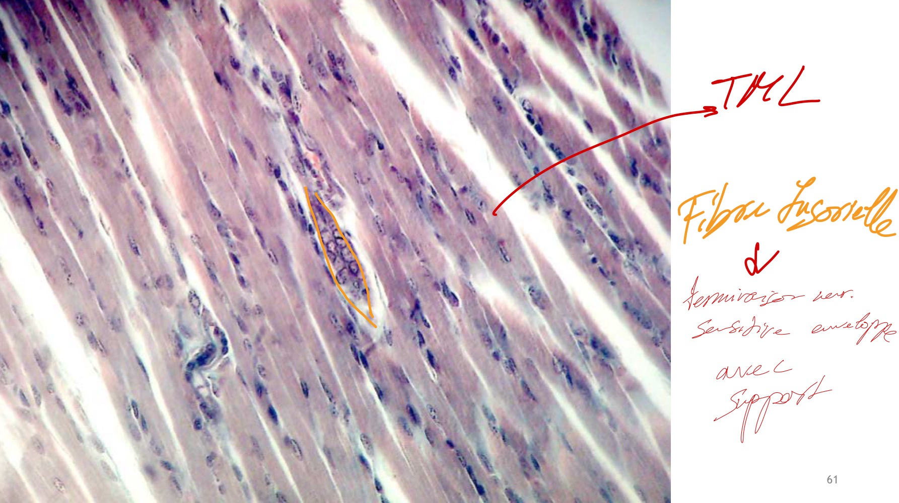 <p>MO, paraffine, TMB </p><p>Tissus musculaire strié squelettique modifié autour du muscle lisse, le tissus nerveux motrice et sensitive organisé chaîne et en sac</p>