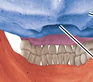 <p>What is the name of this bone in the skull?</p>
