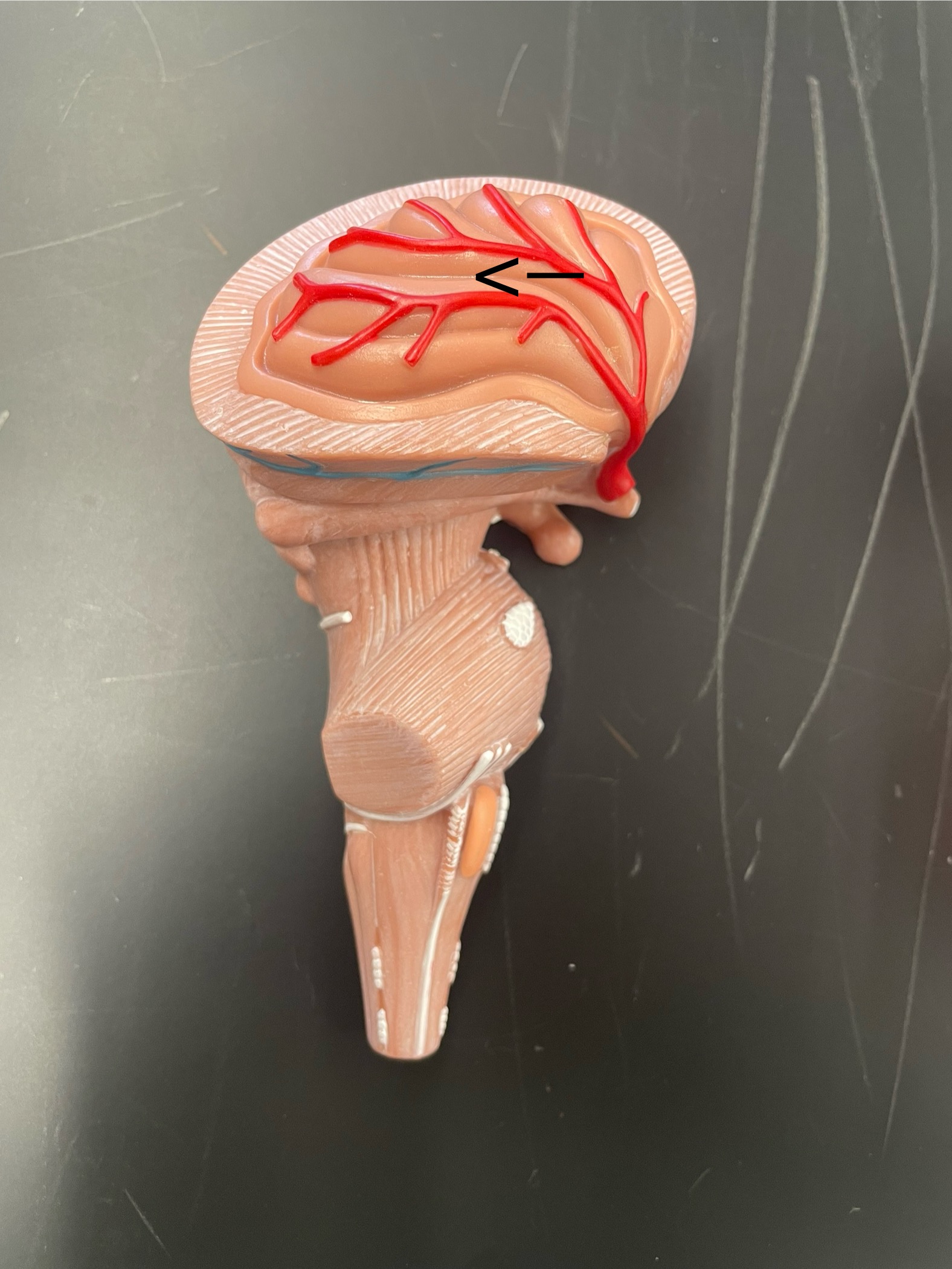 <p>ID lobe</p>