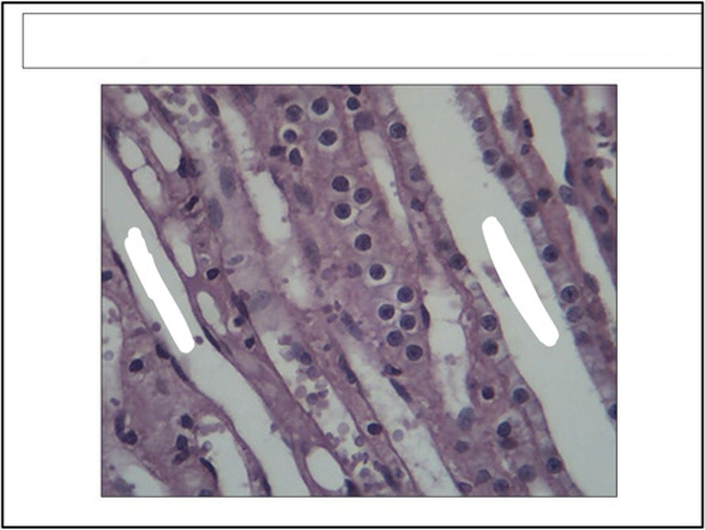 <p>identify this organ/structure</p>