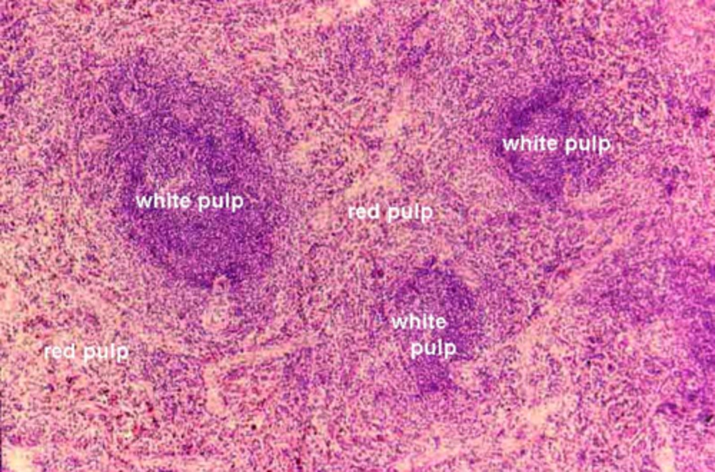 <p>is white pulp or red pulp darker staining (basophilic)?</p>