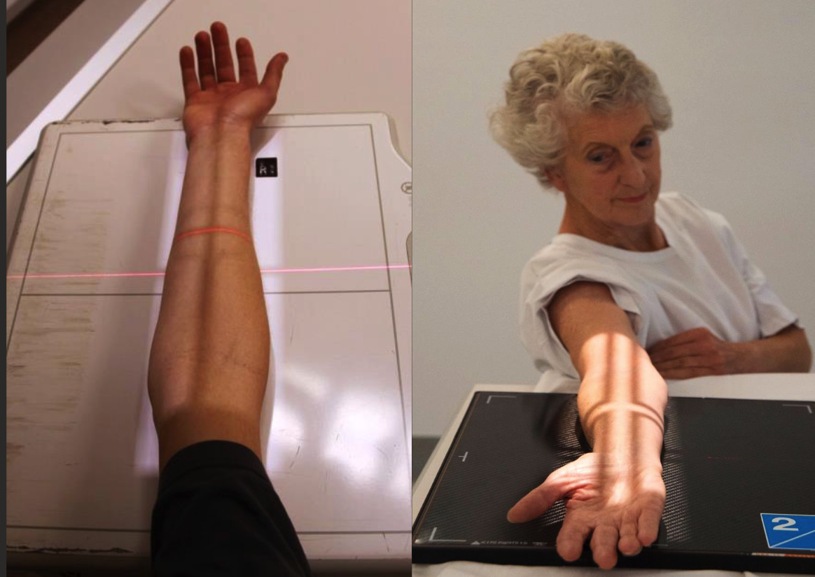 <ul><li><p>Aligned parallel to long edge of IR or diagonally across IR.</p></li><li><p>Hand palm up on IR with arm in full extension.</p></li><li><p>Hand, elbow, and shoulderin same horizontal plane.</p></li><li><p>CR perpendicular to IR.</p></li><li><p>Collimate to include both joints in fiend and include skin edge laterally.</p></li></ul><p></p>