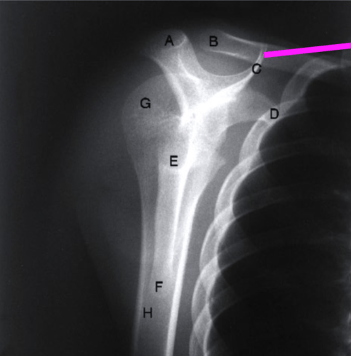 <p>what does the pink line point to?</p>