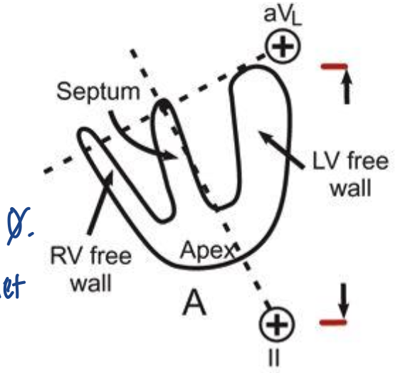 <p><strong>The Electrocardiogram</strong></p><p>What is happening here?</p>