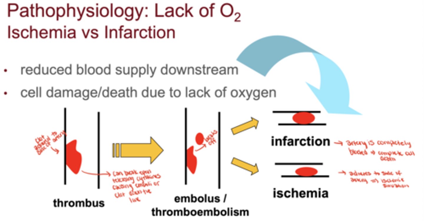 <p>Ischemia = reduced oxygen and reversible damage</p><p>Infarction = cell death due to complete blockage</p>