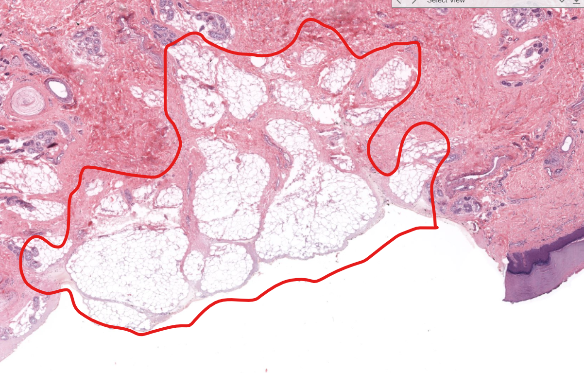 <p>(layer)</p>