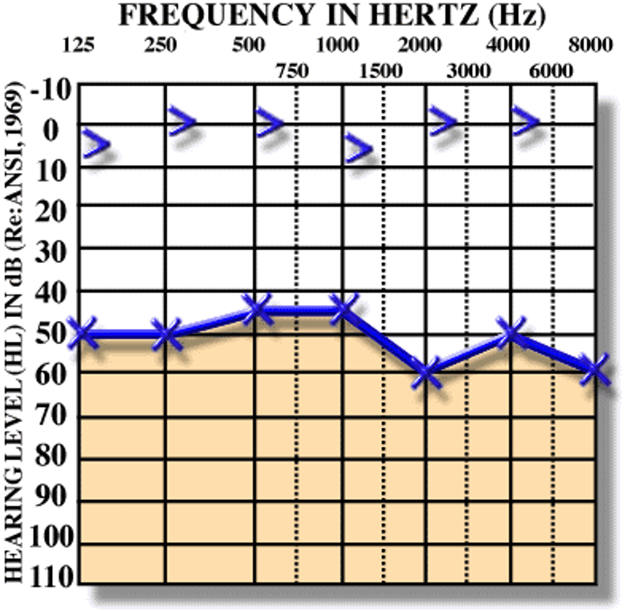 <p>a. 500 Hz = normal speech</p><p>b. Higher dB = hearing capability not good</p><p>c. Normal aging: gradual loss vs. steep loss for those with NHL</p>