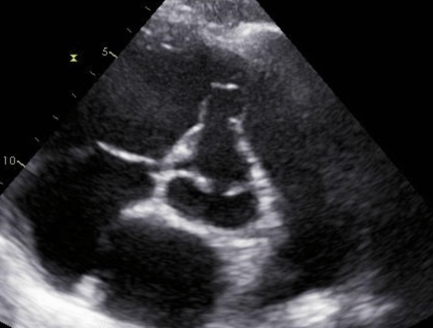 <p>What is seen in the 2D image?</p>