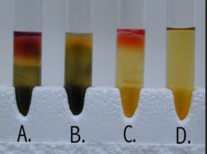 <p>What is/are the reaction/s seen in the culture medium labeled "B"? (If there is more than 1 answer, arrange the answers in alphabetical order following the 1st letter. Also, separate the answers with a comma followed by a space. EXAMPLE: Reaction A, Reaction B)</p>