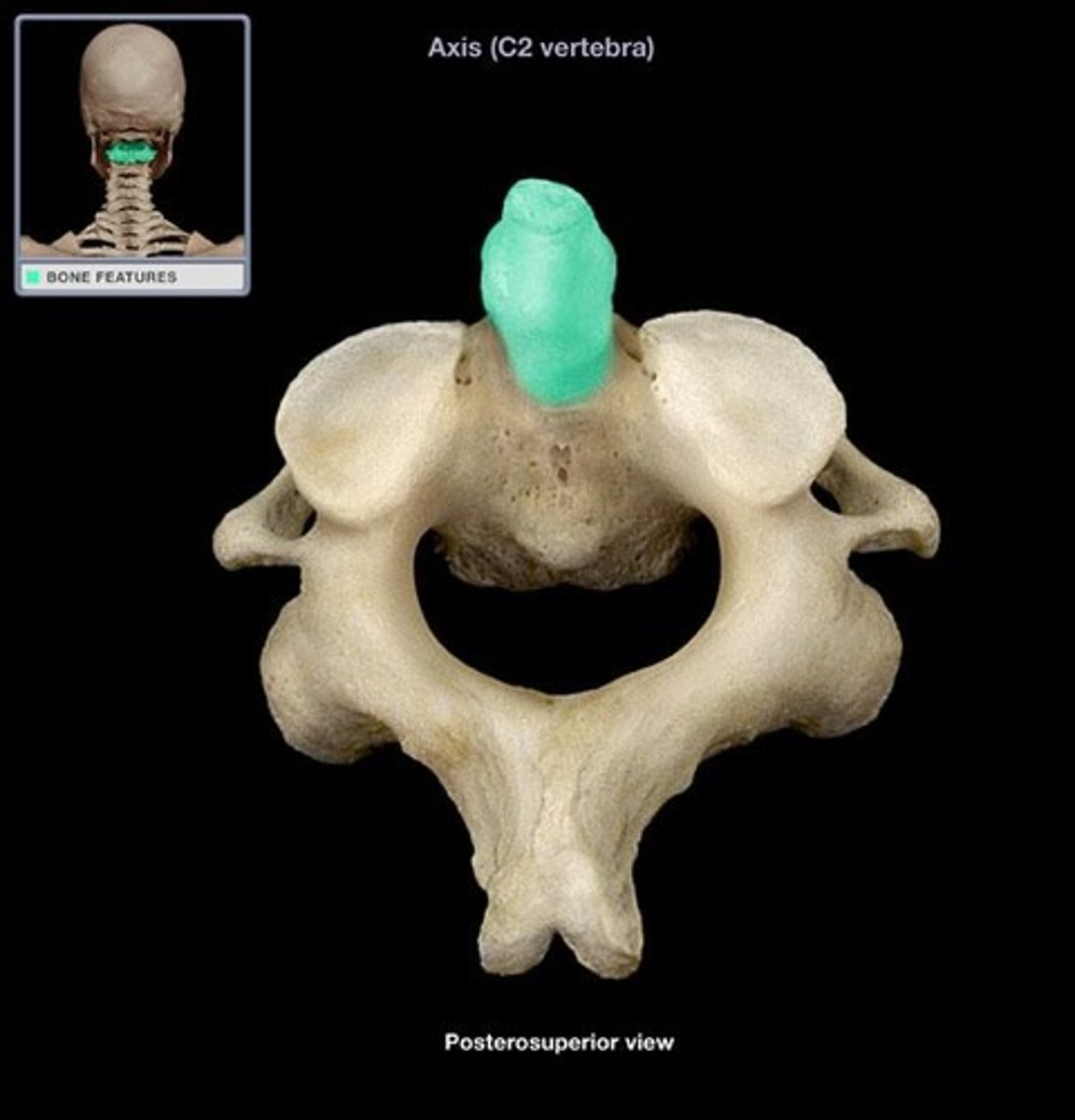 <p>AKA the odontoid process, the projection found only on the axis, allowing the atlas to pivot from side to side</p>