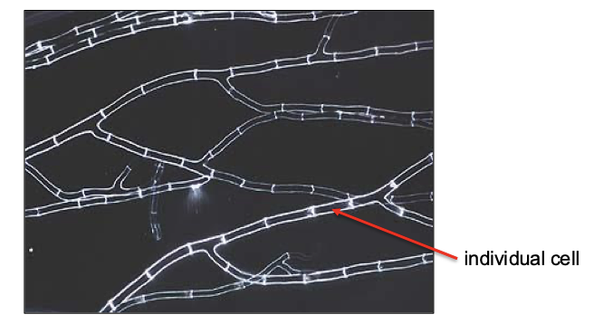 <p>Chain of cells</p>