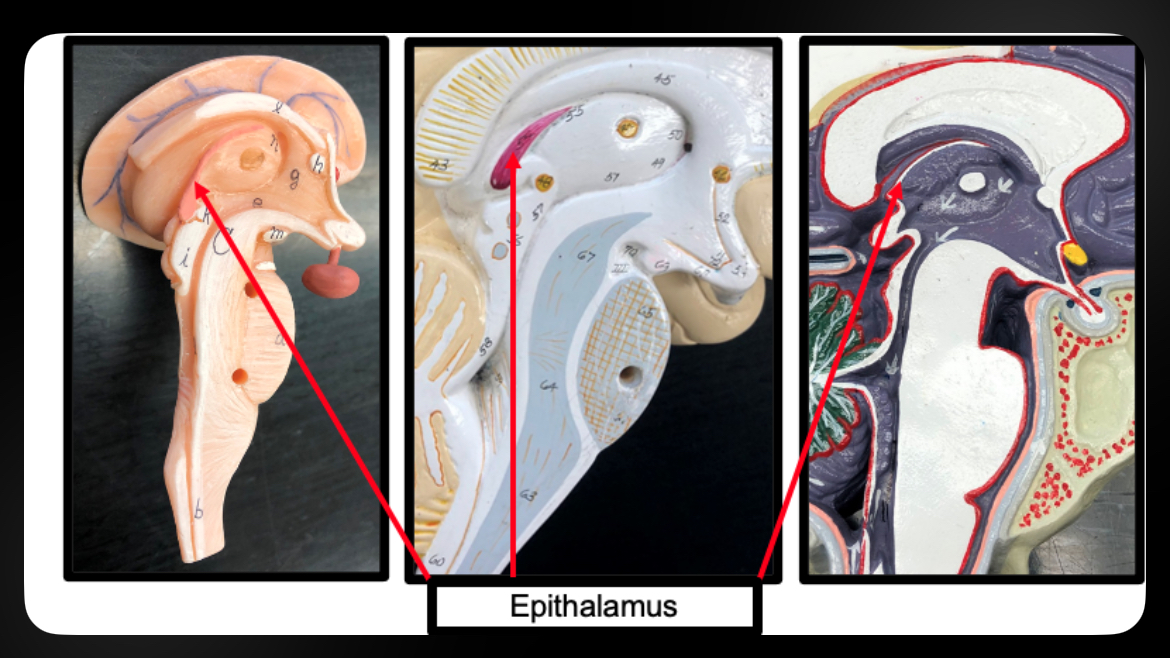 <p>Epithalamus</p>