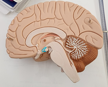 Name the structure (connects to Pituitary Gland)