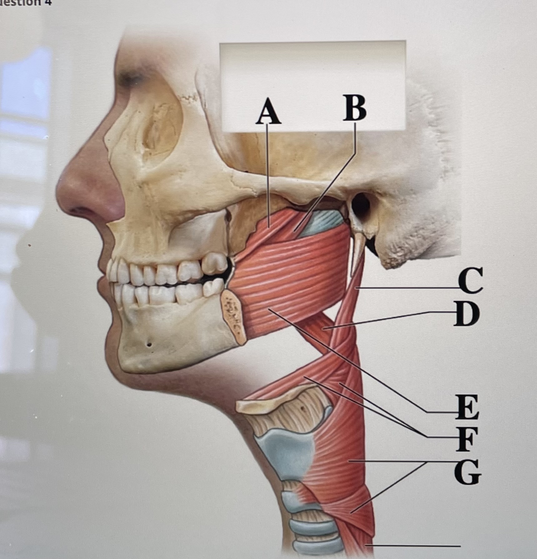 In the figure above,  *is the tensor veil palatini muscle and* _ is the superior pharyngeal constrictor muscle 