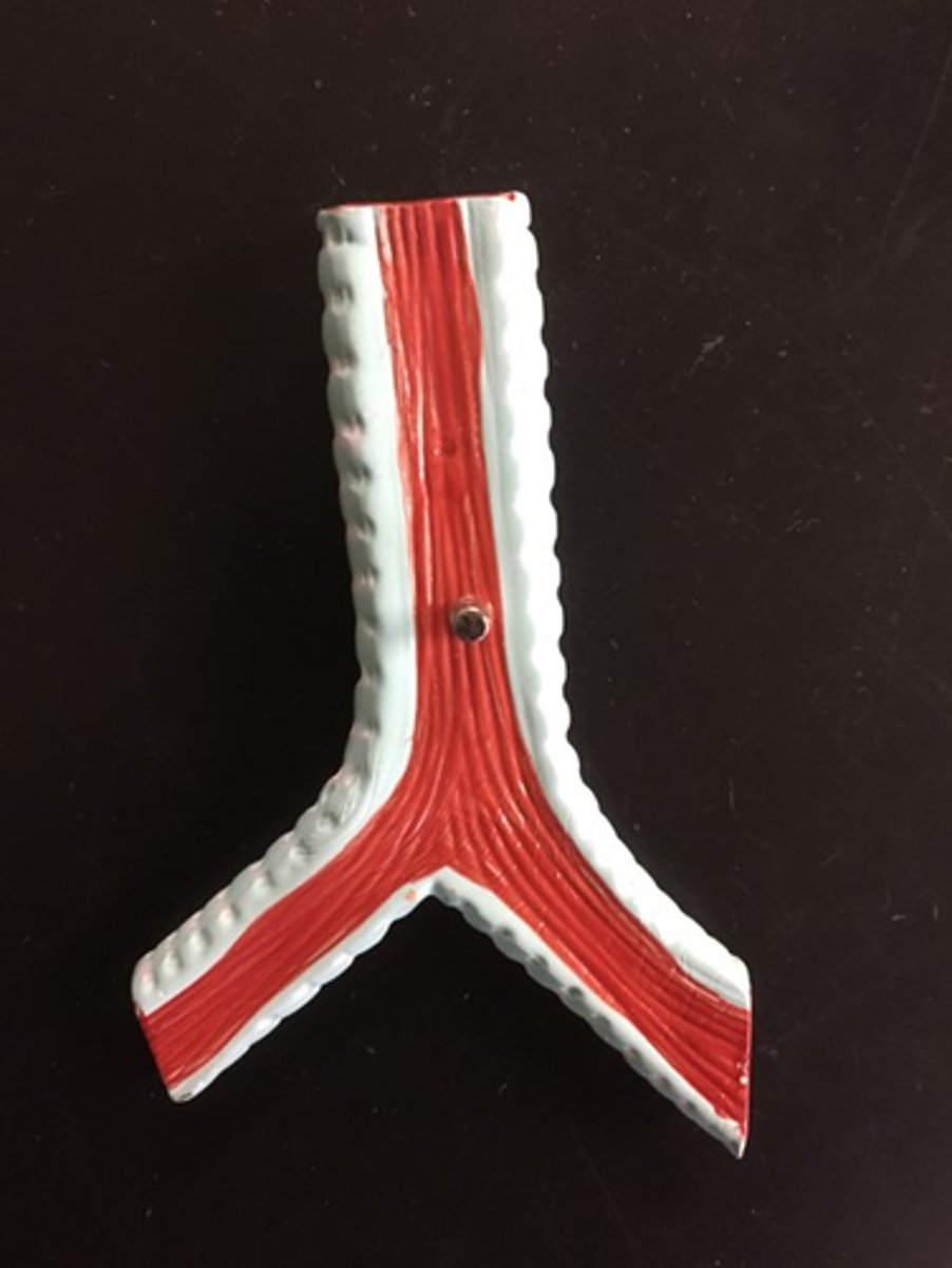 <p>Muscle on the back of the trachea</p>