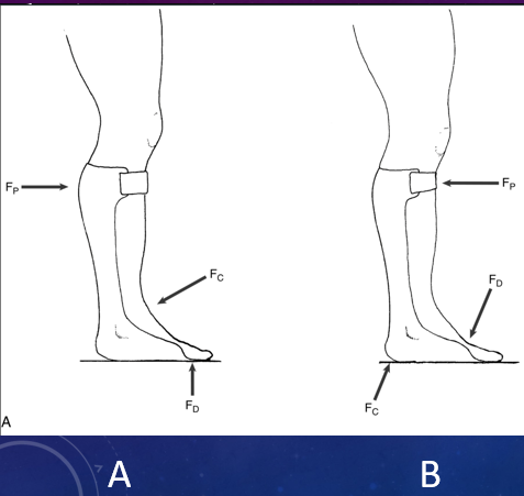 <p>Which of these shows PF is controlled during swing phase by a proximal force (FP) at posterior calf band &amp; a distal force at metatarsal heads (FD) that counter a centrally located stabilizing force (FC) applied at the ankle by shoe closure?</p>