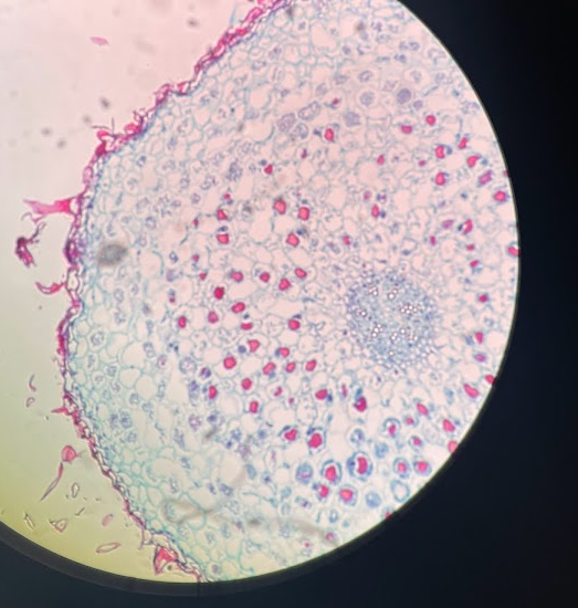 <p>What is this association/fungi?</p>