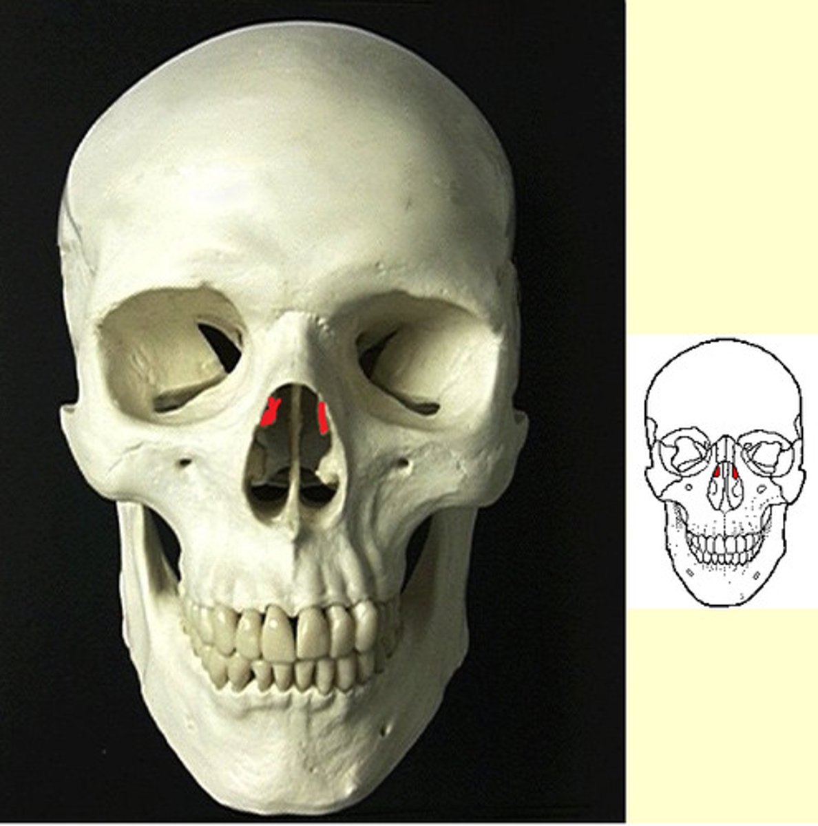 <p>Cribriform plate - Olfactory foramina - Crista galli - Perpendicular plate - Middle nasal concha - Ethmoid sinuses</p>