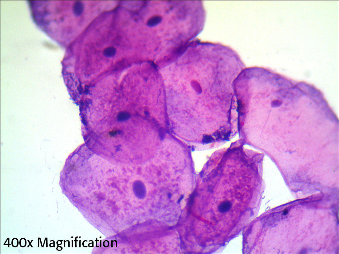 <p>Simple Squamous Epithelium Cells</p>