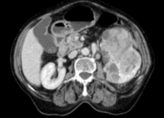 <p><span style="color: rgb(63, 135, 80)">CT Kidneys </span><span style="color: #000000">scan 3</span></p>