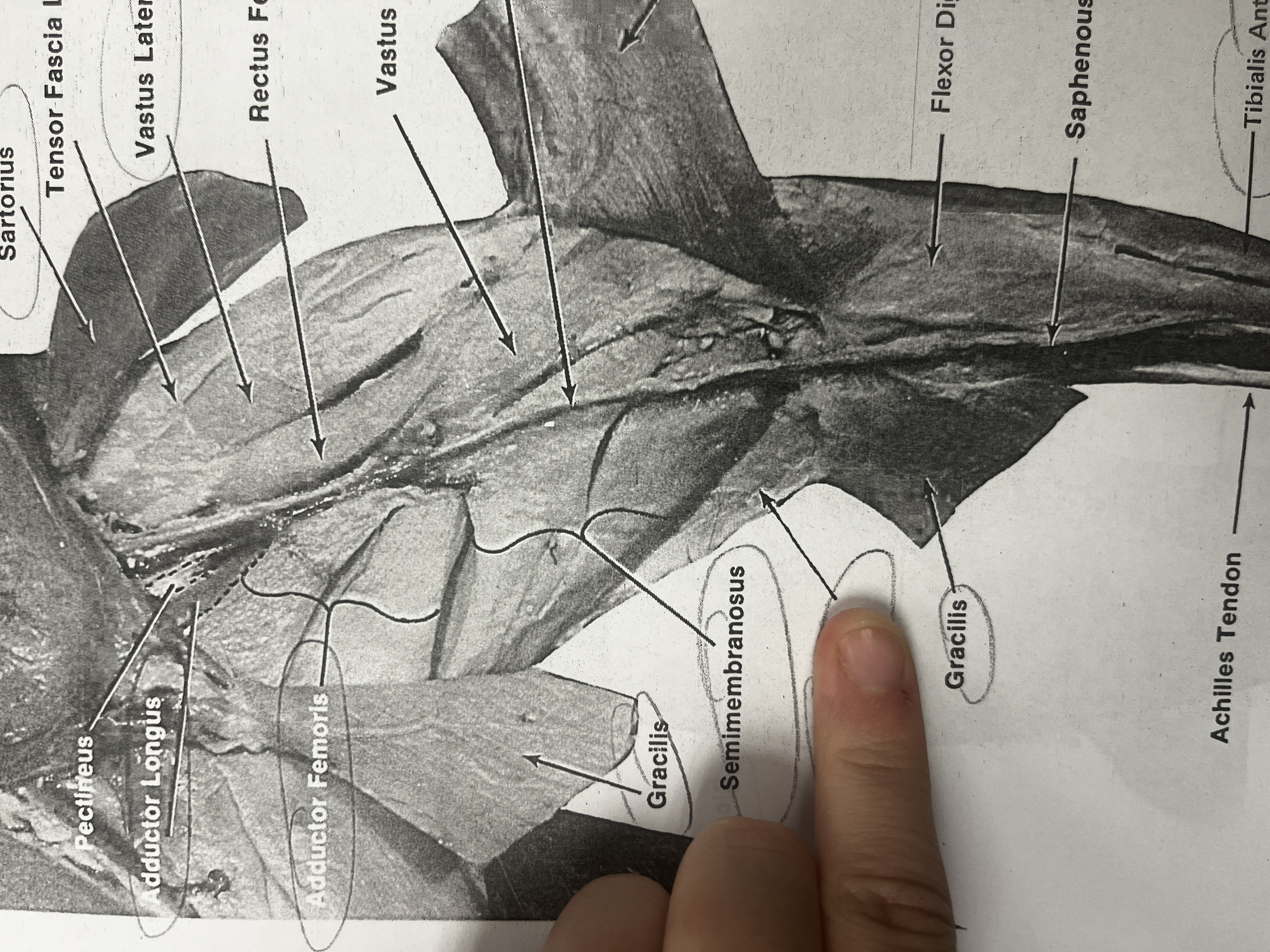 <p>A muscle of the hamstring group that assists in bending the knee.</p>