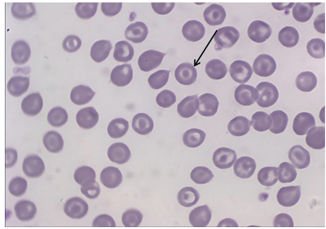<p>What cell is this arrow pointing to?</p>