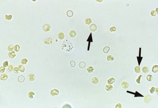 <p>Ghost Cells happen when</p>