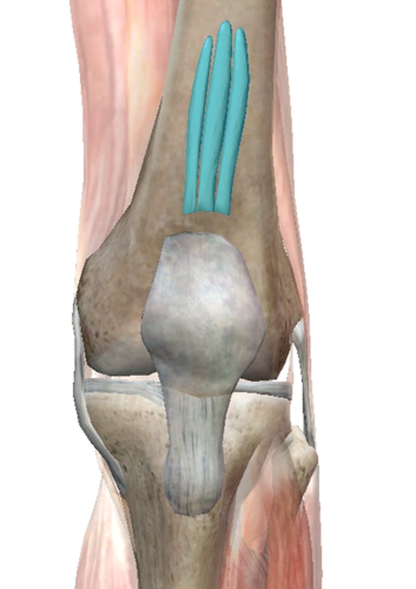 <p>Name the muscle</p>