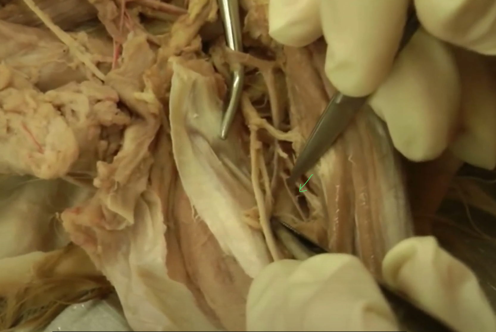<p>what artery is this?</p>