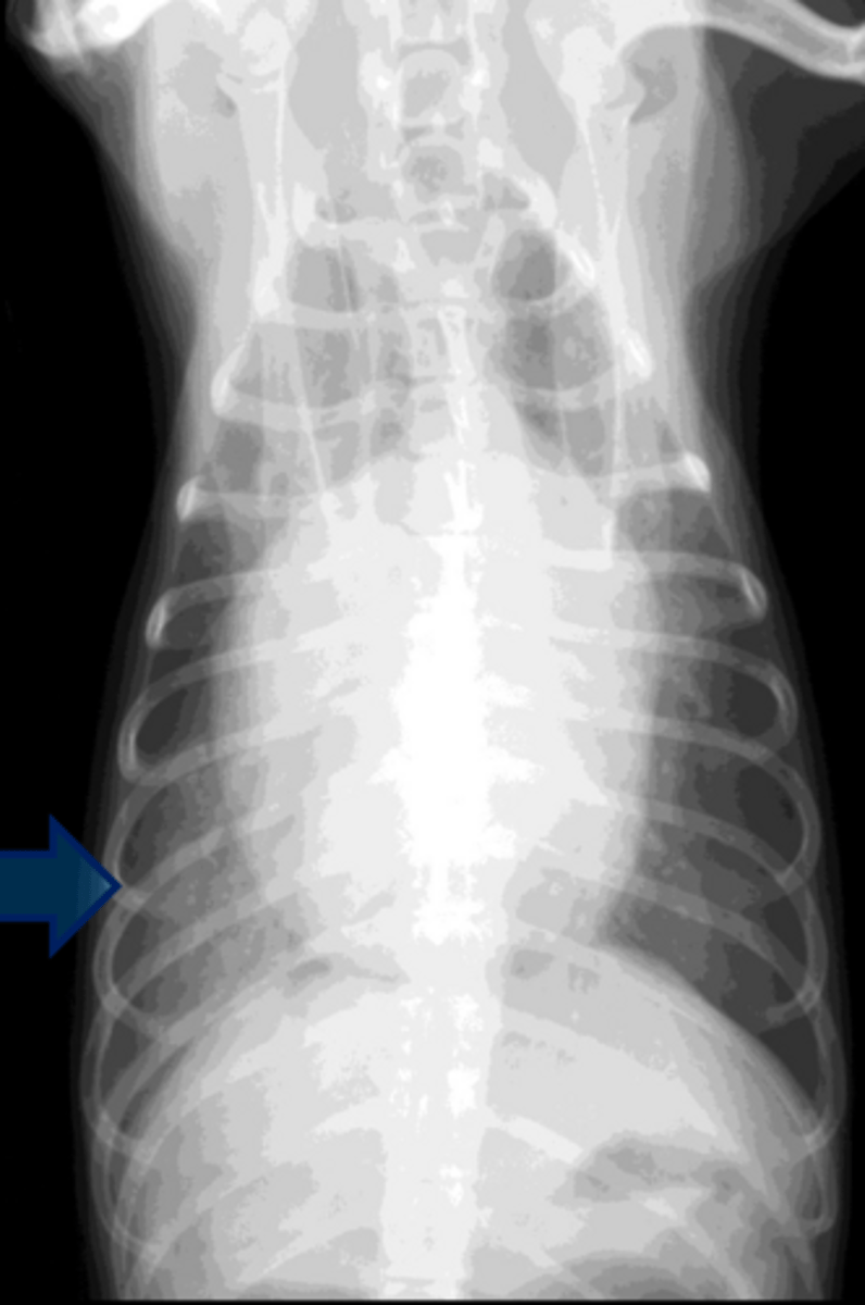 <p>You will not see congestion in the ___ aspect of the lungs before the ____ aspect w/ CHF? </p>