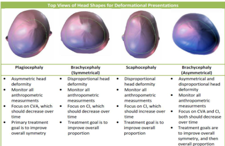 <p>This table shows the different possible abnormal head shapes and the characteristics of each. </p><p></p><p>CI - a width to length ratio to determine asymmetry of head shape </p><p>Cranial Vault Asymmetry (CVA) or Transcranial Diagonal Differential (TTD) - two diagonal measurements taken 30 degrees off of midline compared through subtracting the two.  </p>