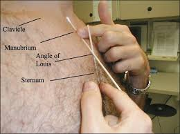 <p>5 cm inferior to sternal notch</p><p>horizontal ridge joining manubrium to body of sternum</p>