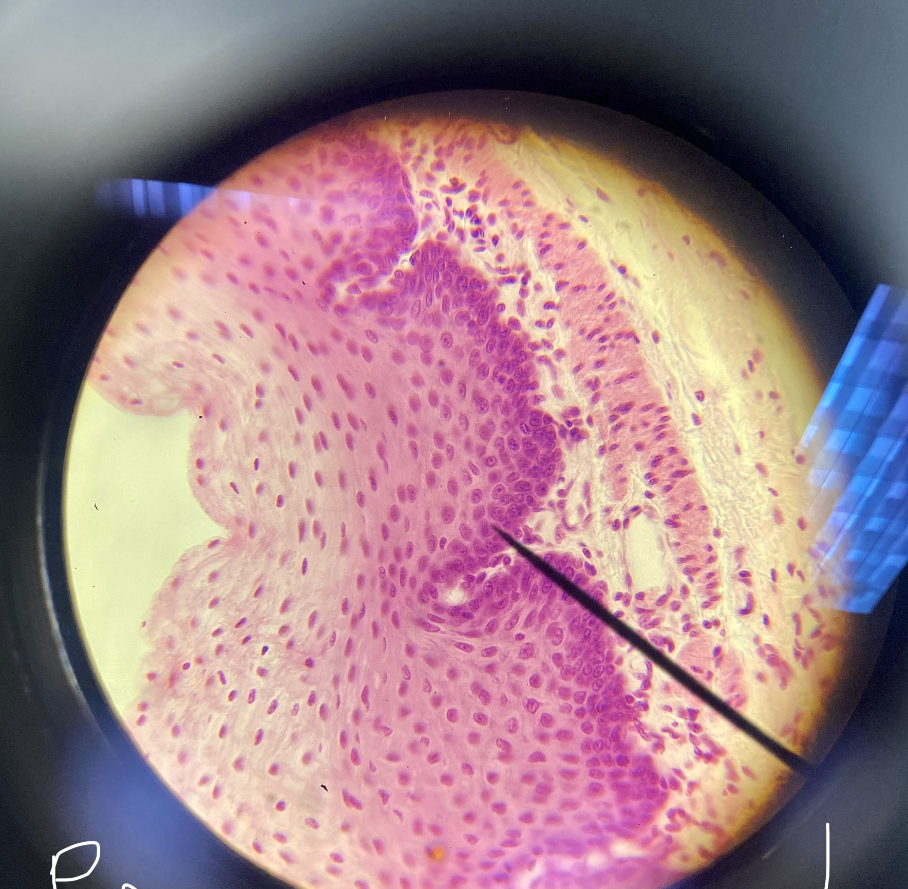 <p>pseudostratified columnar epithelium</p>