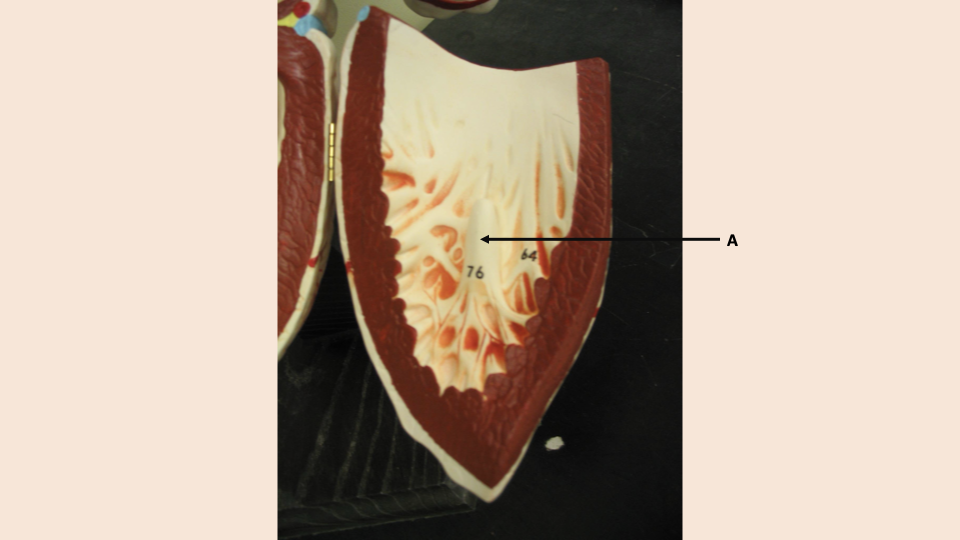<p>what is A</p>