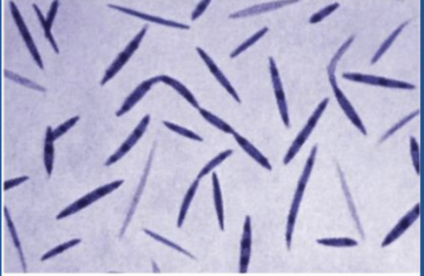 <p>includes photolithoautotrophs and chemoheterotrophs; found in gut and oral cavity; spindle shape; associated with infections and diseases in humans</p>
