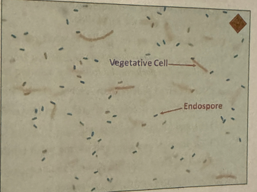<p>endospore staining: endospore location </p>