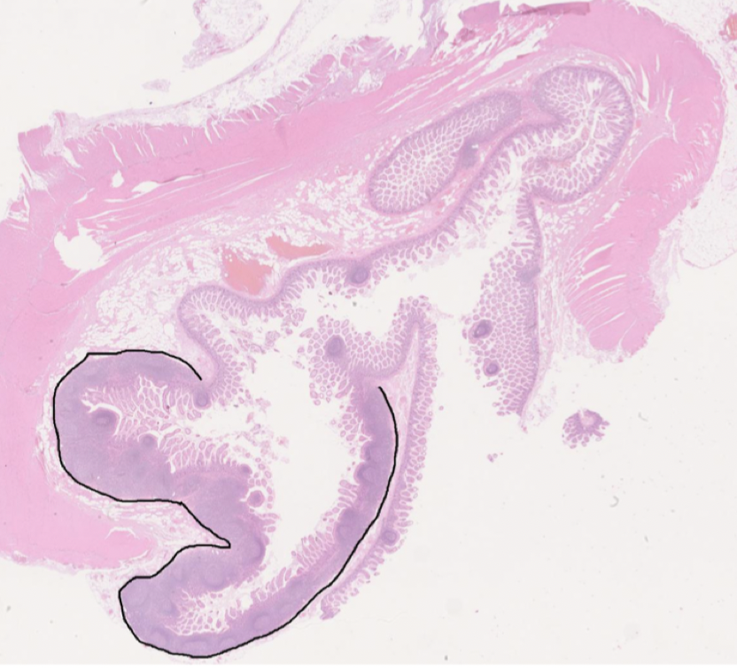 <p>De finns främst i ileum och bildar germinalcentra. De består av flera folliklar och har embryonalt ursprung. </p>