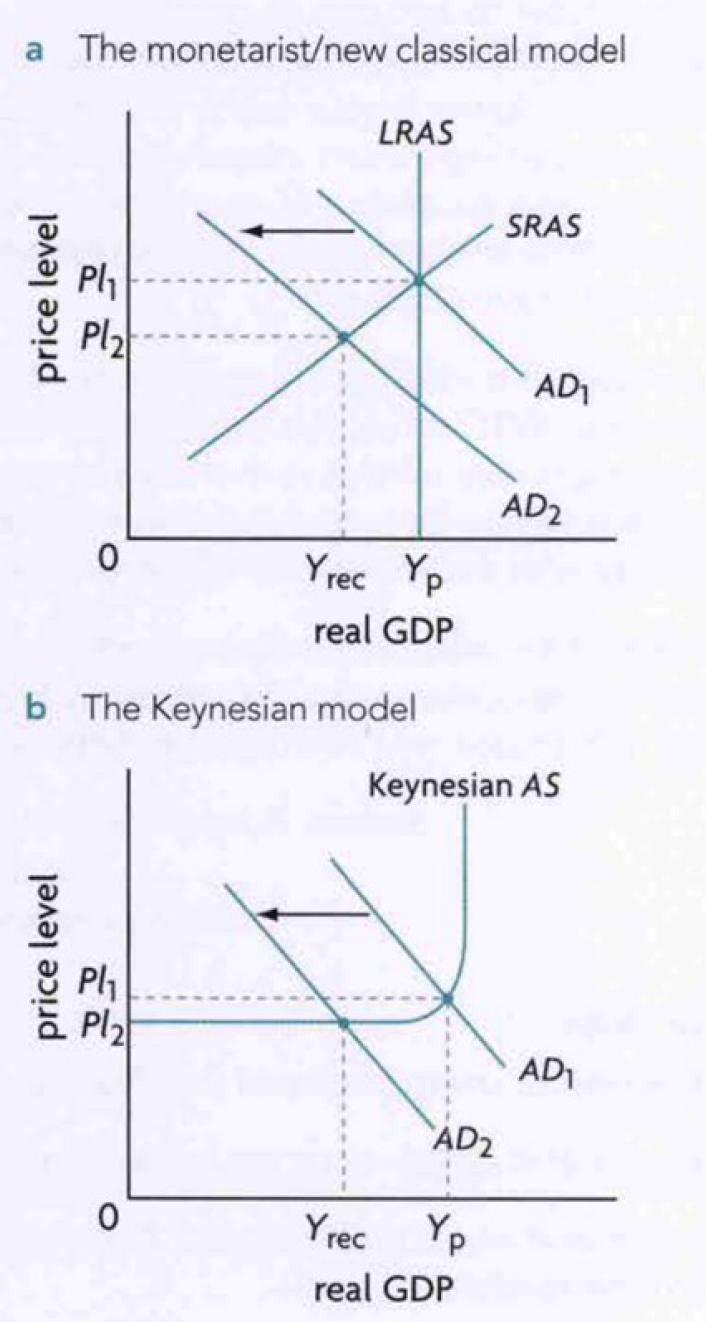 <ul><li><p>initially producing at Yp with zero cyclical unemployment</p></li><li><p>fall in AD causing AD to shift leftward creates a deflationary/recessionary gap as real output fall to Yrec. </p></li><li><p>the new new unemployment at Y rec is the cyclical unemployment</p></li></ul>