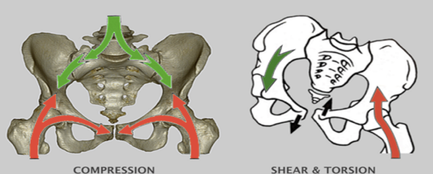 <p>Response of joints to stress</p>