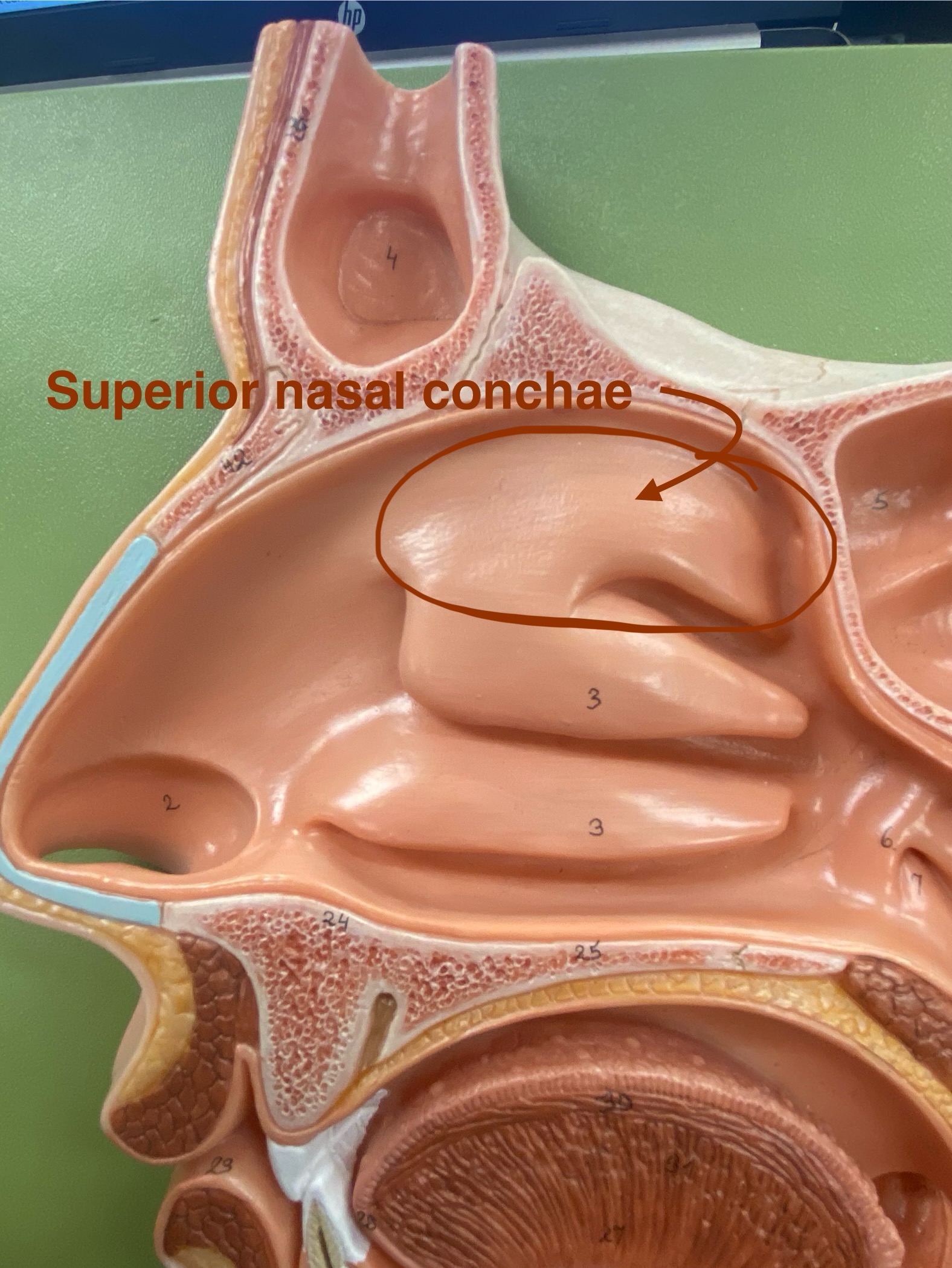 <p>Makes the airflow turbulent and thee surfaces are mucus which traps particles to stop them from going down the trachea</p>