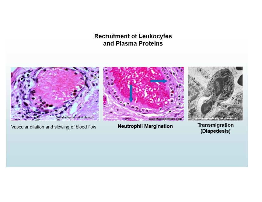 <p>Migration of leukocytes across endothelium </p>