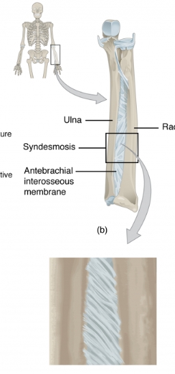 <p> a type of fibrous joint in which two parallel bones are united to each other by fibrous connective tissue.</p>