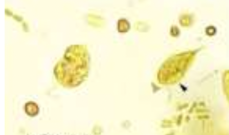 ADDITIONAL INFORMATION: Chilomastix Mesnili:

identify the stain used: 

* brownish in color